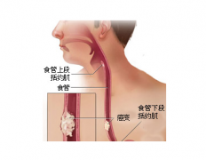 食管癌术后护理的新管理技术