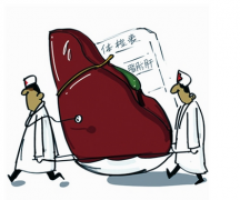 探究当前脂肪肝产生的原因及治疗措施
